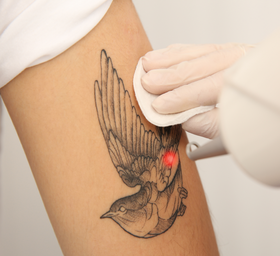 Treatment Image